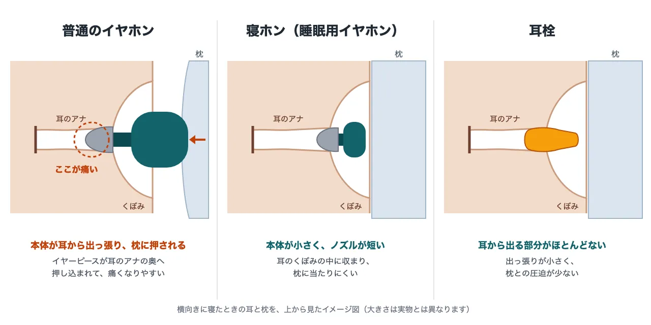 横向きに寝たときの耳と枕を上から見た3つの断面図。普通のイヤホンは本体が耳から出っ張って枕に押され、イヤーピースが耳のアナの奥へ押し込まれる。寝ホンは小さい本体が耳のくぼみに収まり、耳栓は耳から出る部分がほとんどない